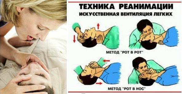 Действия при отравлении выхлопными газами