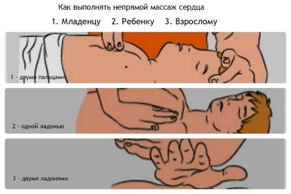 Действия при отравлении выхлопными газами